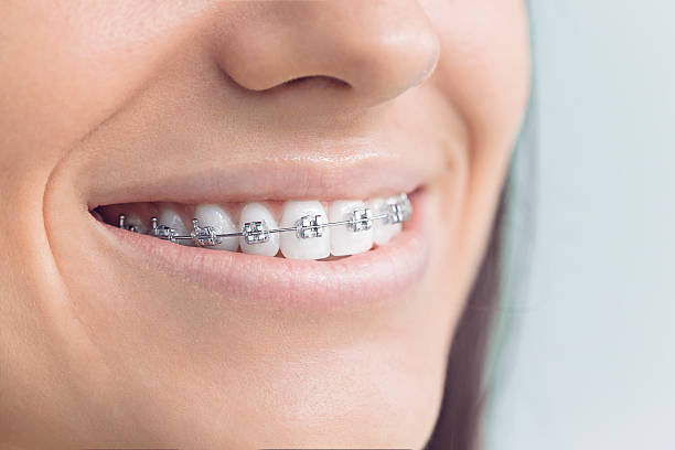 Dental Inlays and Onlays in Chico, WA